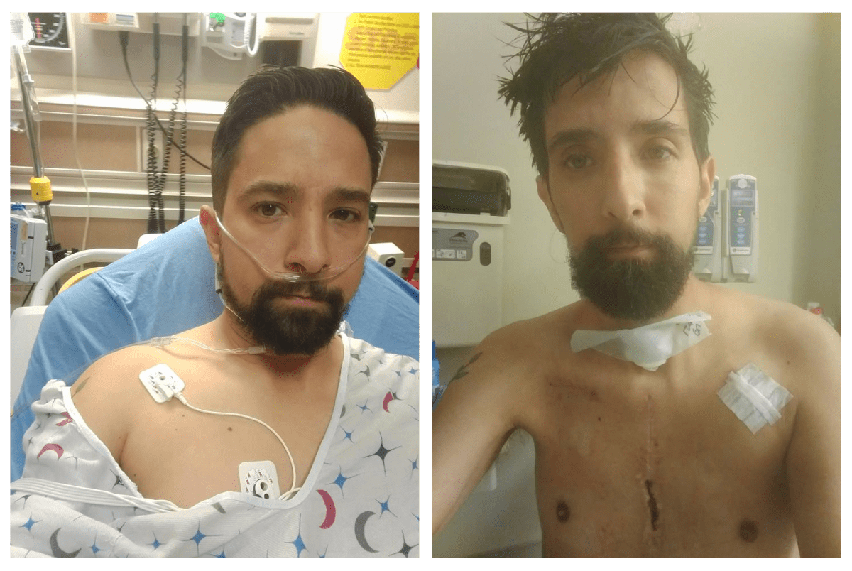 Before & After - Rob Schultze Benefit